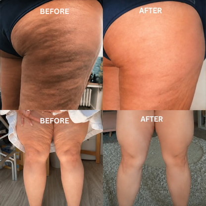 Fast-Acting Anti Cellulite Cream